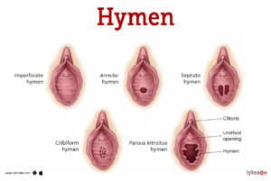 image-of-the-hymen